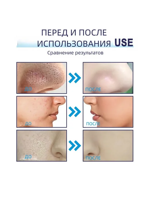Черная угольная маска убирать прыщи Отшелушивающий гладкий, черный, фото 6