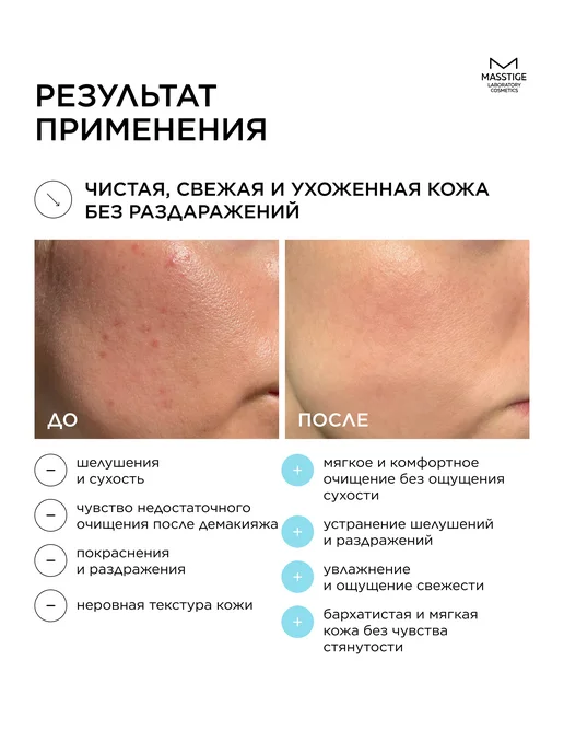MASSTIGE Пенка для умывания лица, 150 мл, фото 2