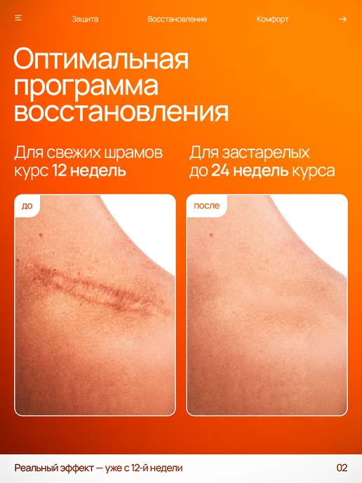Силиконовый пластырь от шрамов и рубцов 4 см х 150 см, вариант, фото 2