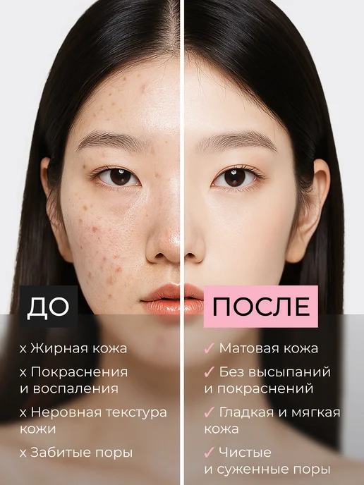 Celimax Эссенция для лица для жирной кожи Корея, 30мл, 30 мл, фото 2