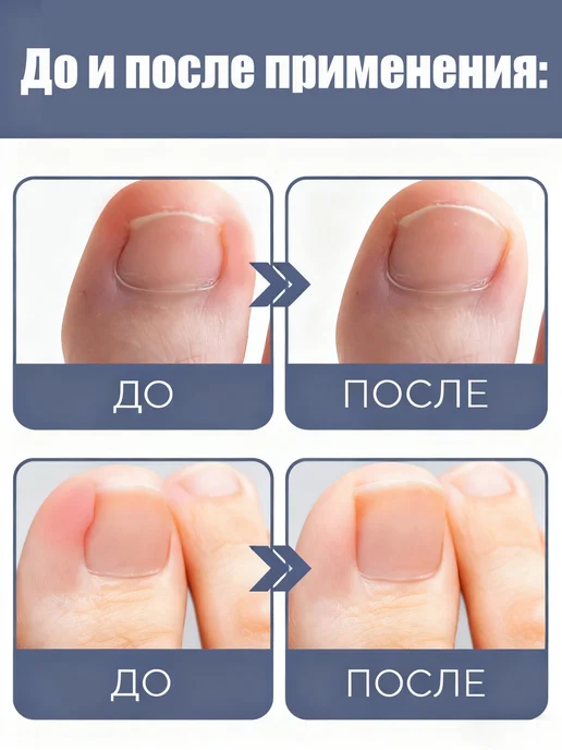 West&Month Масло для ухода за ногтями, 10 мл, фото 4
