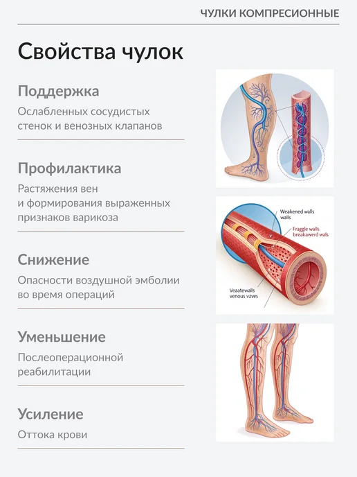 ТМ КМ Компрессионные чулки 1 класса телесные на широкое бедро, бежевый, фото 3