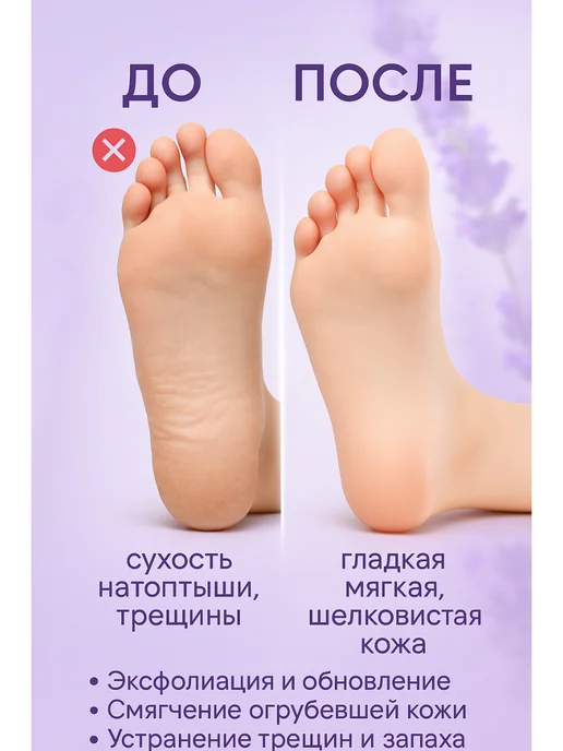 Alexaint Пилинг носочки для ног педикюрные отшелушивающие, белый, фото 3