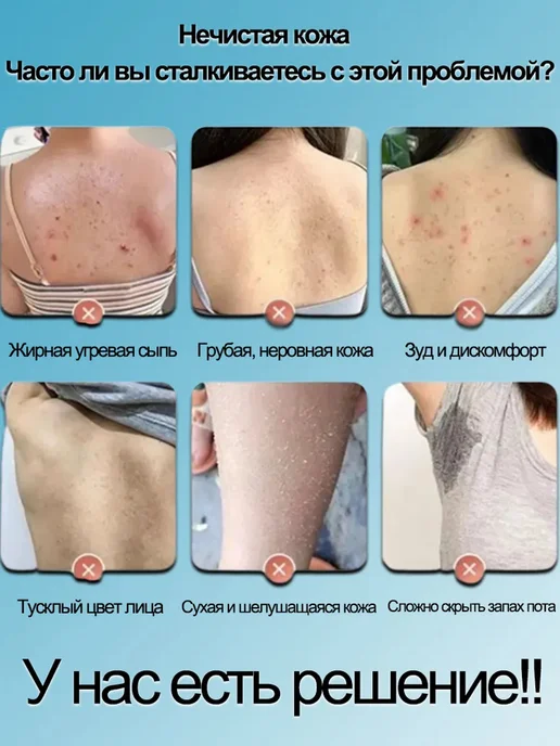 IUALLURE Кислотный Гель для душа от прыщей для тела на спине, вариант, фото 2
