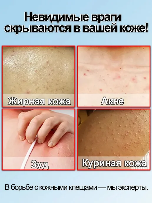 IUALLURE Кислотный Гель для душа от прыщей для тела на спине, вариант, фото 3