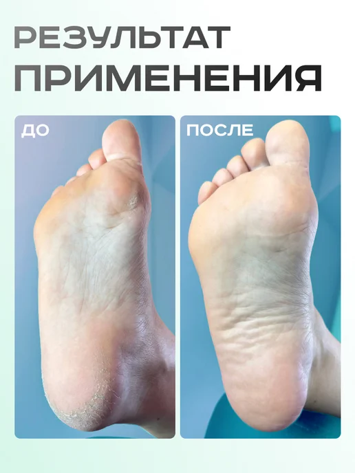 ELNAIL PRO Спонж-полировщик для пяток M, абразивная терка для педикюра, 25 шт, фото 4